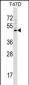 GCNT1 Antibody (Center)